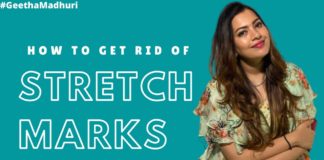 How to Get Rid of Stretch Marks,Geetha Madhuri: Home Remedies for Stretch Marks,#GeethaMadhuri,Do stretch marks ever really go away?,How long do stretch marks take to fade?,How can I get rid of stretch marks naturally?,How are stretch marks caused?