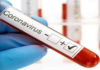 Corona Positive Cases in Maharashtra, Corona Positive Cases In Maharashtra, Maharashtra, Maharashtra , Maharashtra Corona, Maharashtra Corona Cases, Maharashtra Corona Deaths, Maharashtra Corona Positive Cases, Maharashtra Coronavirus, Maharashtra Coronavirus Positive Cases, Maharashtra Coronavirus Updates, Maharashtra COVID 19,mango news