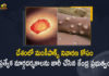 Central Govt Issues Special Guidelines For The Prevention of Monkeypox Disease in Country, Central Issues Special Guidelines For The Prevention of Monkeypox Disease in Country, Govt Issues Special Guidelines For The Prevention of Monkeypox Disease in Country, Special Guidelines For The Prevention of Monkeypox Disease in Country, Special Guidelines For Monkeypox Disease, Monkeypox Disease Special Guidelines, Monkeypox Disease in Country, Monkeypox Disease, Health Ministry issues Special Guidelines to tackle monkeypox, monkeypox, Monkeypox Disease News, Monkeypox Disease Latest News, Monkeypox Disease Latest Updates, Monkeypox Disease Live Updates, Mango News, Mango News Telugu,