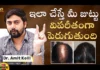 dr AmitKolli, MangoLife, SkinStories, hair loss,hair loss tips,Dermatologist Specialist,Hair loss Diagnosis,hair loss treatment,health tips,skin care,hair growth tips,How to stop hair loss,Tips to Prevent Hair Loss,healthy hair,Mango News