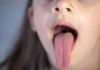 Throw The Tongue The Disease Will Reveal,Tongue Will Reveal Disease, Cracks On The Tongue, Plaque Build-Up On The Tongue, Tongue Discoloration, Tongue Problems,Tongue Cancer,Tongue Health Signs,Tongue Disease,Mango News,Mango News Telugu
