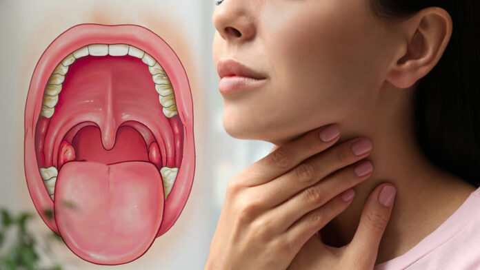 Swelling Of Tonsils Can Be Reduced Like This, Tonsils Can Be Reduced Like This, Tonsils Swelling, Swollen Tonsil Causes, And Treatment, Remedies For Tonsil Infections, Tonsils Problem, Tonsillitis Care Instructions, Tonsil And Adenoid Problems, Causes Of Swollen Tonsils, Mango News, Mango News Telugu,