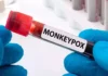 Third Monkeypox Case Registered In The Country, Features Of Monkeyfox, Monkeyfox In Kerala, Monkeypox, Second Mpox Case, Third Monkeypox Case, Monkeypox Case Registered, Mpox, What to know About Mpox Causes, Monkeypox Prevention, Monkeypox Symptoms, New Virus, Health News, Health Tips, Healthy Food, Healthy Diet, Fitness, Mango News, Mango News Telugu