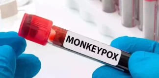 Third Monkeypox Case Registered In The Country, Features Of Monkeyfox, Monkeyfox In Kerala, Monkeypox, Second Mpox Case, Third Monkeypox Case, Monkeypox Case Registered, Mpox, What to know About Mpox Causes, Monkeypox Prevention, Monkeypox Symptoms, New Virus, Health News, Health Tips, Healthy Food, Healthy Diet, Fitness, Mango News, Mango News Telugu