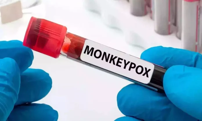 Third Monkeypox Case Registered In The Country, Features Of Monkeyfox, Monkeyfox In Kerala, Monkeypox, Second Mpox Case, Third Monkeypox Case, Monkeypox Case Registered, Mpox, What to know About Mpox Causes, Monkeypox Prevention, Monkeypox Symptoms, New Virus, Health News, Health Tips, Healthy Food, Healthy Diet, Fitness, Mango News, Mango News Telugu