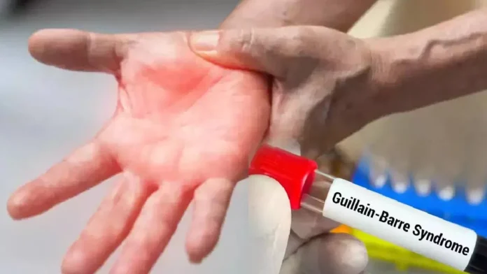 Guillain Barre Syndrome First Case In The State How Dangerous Is It, Guillain Barre Syndrome First Case, First Case In The State, Guillain Barre Syndrome Symptoms, Guillain-Barré syndrome Treatment, Guillain Barré Syndrome, Immune System, Neurological Disorder, Treatment Cost, Hyderabad, Hyderabad Live Updates, Latest Hyderabad News, Telangana, TS Politics, TS Live Updates, Political News, Mango News, Mango News Telugu