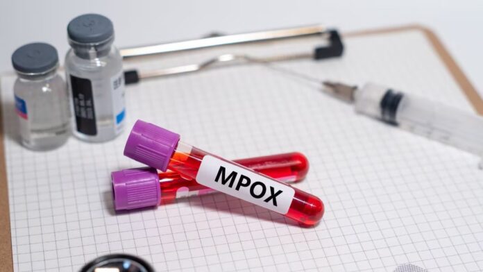 First Mpox Case Reported In Bengaluru Government On High Alert