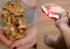 These Can Reduce Uric Acid Levels, Reduce Uric Acid, Tips For Uric Acid, Effects Of Uric Acid, Tips To Reduce Uric Acid, Reduce Uric Acid Levels, Uric Acid, Foods to Help Reduce Uric Acid, Natural Ways to Reduce Uric Acid, Health, Health News, Health Tips, Healthy Food, Healthy Diet, Fitness, Mango News, Mango News Telugu