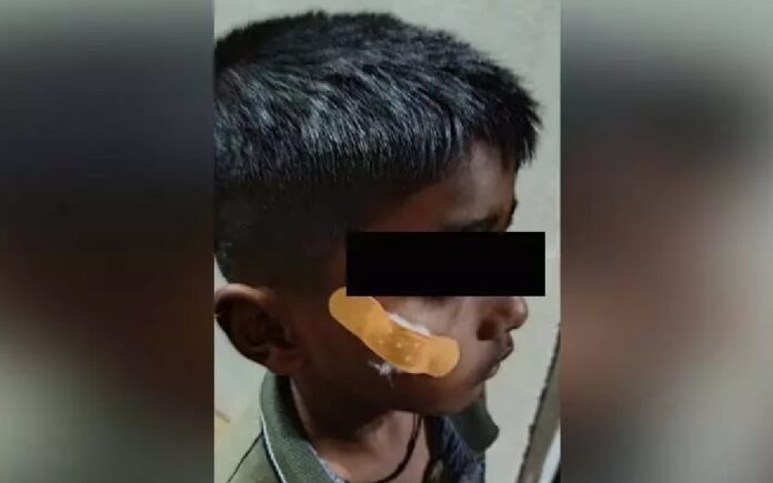 Fevikwik Treatment A Shocking Incident In Karnataka Government Hospital, Fevikwik Treatment, A Shocking Incident In Karnataka, Karnataka Government Hospital, Fevikwik, Government Hospital, Medical Negligence, Nurse, Karnataka, Latest Karnataka News, Live Updates, Breaking News, Headlines, Live News, Mango News, Mango News Telugu