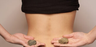 If You Have Kidney Stones You Can Reduce Them Without Going For Surgery, If You Have Kidney Stones, Kidney Stones, You Can Reduce Them Without Going For Surgery, Prevent Kidney Stones, Kidney Stone Diet Plan, Kidney Stones Causes, Health, Health News, Health Tips, Healthy Food, Healthy Diet, Mango News, Mango News Telugu