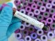 Andhra Pradesh, AP Corona Cases, AP Corona Positive Cases, AP Coronavirus, AP COVID 19 Cases, AP Total Positive Cases, Corona Positive Cases, Coronavirus, COVID-19, State wise Corona Positive Cases, telangana, Telangana Corona Positive Cases, Telangana Coronavirus, Telangana Coronavirus Deaths