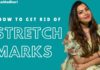 How to Get Rid of Stretch Marks,Geetha Madhuri: Home Remedies for Stretch Marks,#GeethaMadhuri,Do stretch marks ever really go away?,How long do stretch marks take to fade?,How can I get rid of stretch marks naturally?,How are stretch marks caused?