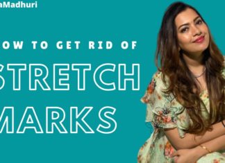 How to Get Rid of Stretch Marks,Geetha Madhuri: Home Remedies for Stretch Marks,#GeethaMadhuri,Do stretch marks ever really go away?,How long do stretch marks take to fade?,How can I get rid of stretch marks naturally?,How are stretch marks caused?