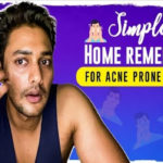 Acne Treatment At Home For Oily Skin,Acne Home Remedies,Home Remedies,How to Get Rid Of Acne,How To Get Rid Of Pimples,Prince Cecil,Acne Removal,Prince Cecil Channel,Prince Cecil Youtube Channel,The Prince Way,Best Way To Get Rid Of Acne,Get Rid Of Pimples Fast,Face Care,Best Acne Treatment,Dry Skin,Oily Skin Care,Skincare Routines,Get Rid Of Acne Overnight,How To Cure Acne Naturally,Home Skincare,Prince Telugu Movies,Get Rid Of Acne Scars