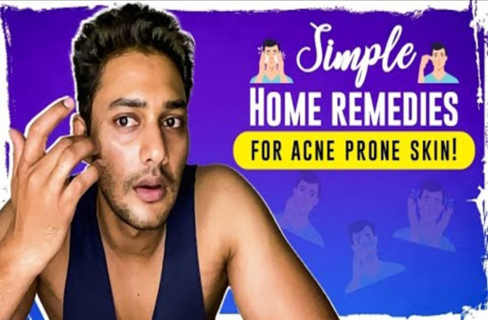 Acne Treatment At Home For Oily Skin,Acne Home Remedies,Home Remedies,How to Get Rid Of Acne,How To Get Rid Of Pimples,Prince Cecil,Acne Removal,Prince Cecil Channel,Prince Cecil Youtube Channel,The Prince Way,Best Way To Get Rid Of Acne,Get Rid Of Pimples Fast,Face Care,Best Acne Treatment,Dry Skin,Oily Skin Care,Skincare Routines,Get Rid Of Acne Overnight,How To Cure Acne Naturally,Home Skincare,Prince Telugu Movies,Get Rid Of Acne Scars
