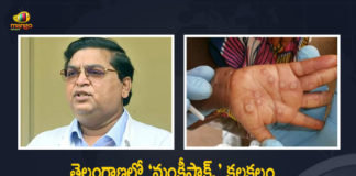 Telangana Fever Hospital Superintendent Responds Over Health Condition of Suspected Kamareddy Monkeypox Patient, Fever Hospital Superintendent Responds Over Health Condition of Suspected Kamareddy Monkeypox Patient, Health Condition of Suspected Kamareddy Monkeypox Patient, Kamareddy Monkeypox Patient, Telangana Monkeypox Patient, Telangana Fever Hospital Superintendent, Fever Hospital Superintendent, Telangana first suspected Monkeypox case, Telangana Monkeypox case, TS Reports Suspected Monkeypox case, Telangana Monkeypox case News, Telangana Monkeypox case Latest News, Telangana Monkeypox case Latest Updates, Telangana Monkeypox case Live Updates, Mango News, Mango News Telugu,