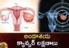 The Increasing Threat of Ovarian Cancer in Women Know The Symptoms,The Increasing Threat of Ovarian Cancer,Ovarian Cancer in Women,Know The Symptoms of Ovarian Cancer,Mango News,Mango News Telugu,Various cancers,ovarian cancer, The increasing threat of ovarian cancer in women, ovarian cancer symptoms, Cancer diagnosis,Awareness of ovarian cancer,Ovarian Cancer Risk Factors,Threat of Ovarian Cancer Latest News,Threat of Ovarian Cancer Latest Updates,Ovarian Cancer Latest News,Ovarian Cancer Latest Updates