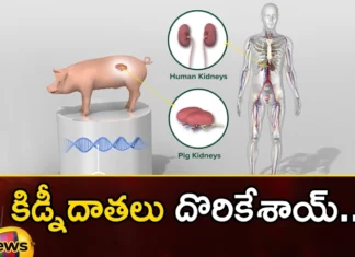 Human Pig Kidney Experiment,Human Kidney Experiment Success,Human Pig Kidney Experiment Success,Mango News,Mango News Telugu,Kidney Experiment,Kidney Bean Experiment,Pig Kidney Works,Pig Kidney Transplant Experiment,Us Surgeons Transplant Pig Kidney,Pig Kidneys Transplanted,Pig Kidney Xenotransplantation,Pig Kidney In A Human Body,Pig Kidney Transplant 2023,Pig Kidney Transplant Update,Pig Kidney Transplant Latest News