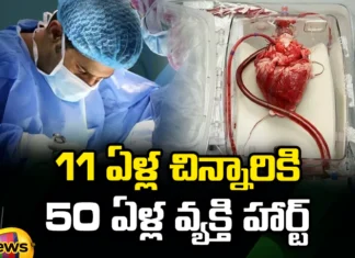 11 Year Old Child Undergoes Heart Transplant Surgery Successfully, 11 Year Old Child Undergoes Heart Transplant, Child Undergoes Heart Transplant Surgery, 11 Year Old Child Heart Transplant Surgery, Child Heart Transplant Surgery, Heart Transplant Surgery, Heart Surgery, Tirupathi, Sri Padmavathi Hrudayalaya, Latest 11 Year Old Child Heart Transplant Surgery News, Child Heart Transplant Surgery Latest News, Health News, Health Tips, Latest Health News, Mango News, Mango News English