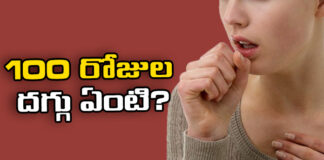 What is a 100 day cough,100 day cough,What is cough,Covid,United Kingdom,UKHSA, What is a 100 day cough, UK residents fear,Cough,Mango News,Mango News Telugu,Whooping Cough,UK Health Officials Issue,Signs of Whooping Cough,Symptoms of Whooping Cough,UK residents fear News Today,UK Health Officials Latest News,UK residents Latest News,UK residents Latest Updates,100 day cough Latest News
