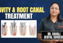 What Precautions Should Be Taken To Prevent Dental Problems? Says By Dr Ravali, What Precautions Should Be Taken, To Prevent Dental Problems, Dental Problems, Dental Precautions Says By Dr Ravali, Mango Life, Oral Hygiene, Dental Care, Advaita Dental Care, Dental Precautions, Health News, Health Tips, Healthy Tips, Mango News, Mango News Telugu