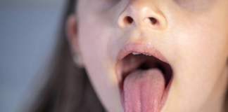 Throw The Tongue The Disease Will Reveal,Tongue Will Reveal Disease, Cracks On The Tongue, Plaque Build-Up On The Tongue, Tongue Discoloration, Tongue Problems,Tongue Cancer,Tongue Health Signs,Tongue Disease,Mango News,Mango News Telugu