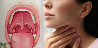 Swelling Of Tonsils Can Be Reduced Like This, Tonsils Can Be Reduced Like This, Tonsils Swelling, Swollen Tonsil Causes, And Treatment, Remedies For Tonsil Infections, Tonsils Problem, Tonsillitis Care Instructions, Tonsil And Adenoid Problems, Causes Of Swollen Tonsils, Mango News, Mango News Telugu,