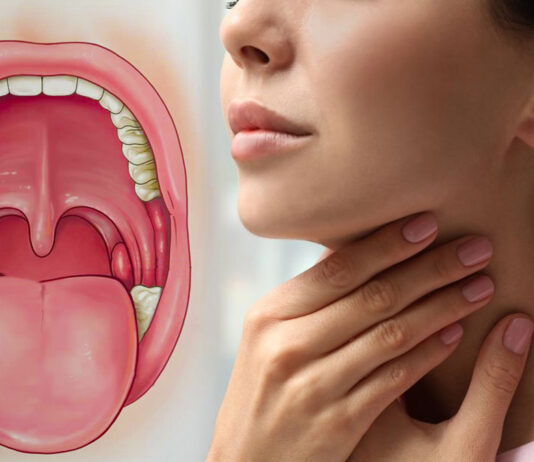 Swelling Of Tonsils Can Be Reduced Like This, Tonsils Can Be Reduced Like This, Tonsils Swelling, Swollen Tonsil Causes, And Treatment, Remedies For Tonsil Infections, Tonsils Problem, Tonsillitis Care Instructions, Tonsil And Adenoid Problems, Causes Of Swollen Tonsils, Mango News, Mango News Telugu,