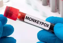 దేశంలో మూడో మంకీపాక్స్ కేసు నమోదు.. Third Monkeypox Case Registered In The Country, Features Of Monkeyfox, Monkeyfox In Kerala, Monkeypox, Second Mpox Case, Third Monkeypox Case, Monkeypox Case Registered, Mpox, What to know About Mpox Causes, Monkeypox Prevention, Monkeypox Symptoms, New Virus, Health News, Health Tips, Healthy Food, Healthy Diet, Fitness, Mango News, Mango News Telugu
