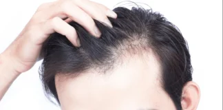 Do This To Prevent Hair Fall, Get Rid Of Hair Problems, Hair Problems, Black, Hair Fall, Hair Tips, Thick Hair, Common Hair Problems, Hair Loss Tips, Home Remedies for Dry Hair, Tips For Black Hair, Black Hair Tips, Health News, Health Tips, Healthy Food, Healthy Diet, Fitness, Mango News, Mango News Telugu