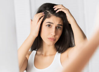 Worried About Hair Loss And Dandruff, Hair Loss And Dandruff, Control It With Simple Tips, Dandruff, Experts, Hair Loss, Hair Loss Tips, Effects Of Hair Loss, Home Remedies for Dry Hair, Tips For Black Hair, Black Hair Tips, Health News, Health Tips, Healthy Food, Healthy Diet, Fitness, Mango News, Mango News Telugu