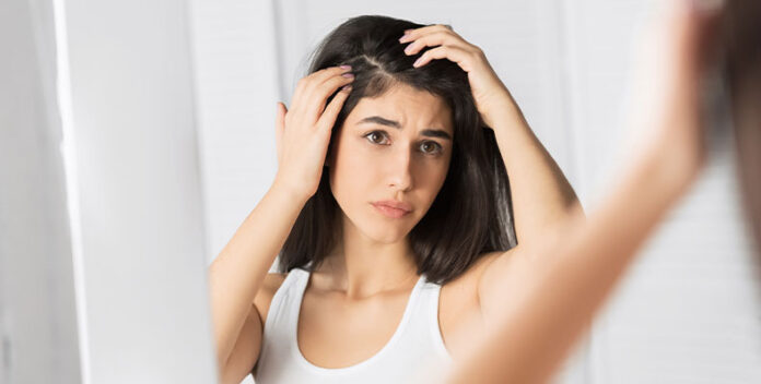 Worried About Hair Loss And Dandruff, Hair Loss And Dandruff, Control It With Simple Tips, Dandruff, Experts, Hair Loss, Hair Loss Tips, Effects Of Hair Loss, Home Remedies for Dry Hair, Tips For Black Hair, Black Hair Tips, Health News, Health Tips, Healthy Food, Healthy Diet, Fitness, Mango News, Mango News Telugu