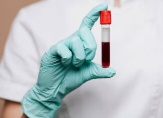 Alert For Women Over 40 These Tests Should Be Done Every Year, Tests Should Be Done Every Year, Women Over 40 These Tests Should Be Done, Alert For Women Over 40, Anemia Test, Blood Glucose Test, Blood Pressure Test, BMD, Bone Density Test, Cholesterol Checkup, Mammography, Regular Blood Tests, Tests Should Be Done Every Year, Vitamin D, Women Over 40, Health, Health News, Health Tips, Healthy Food, Healthy Diet, Fitness, Mango News, Mango News Telugu