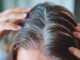 This Tea Turns White Hair Black, Tea Turns White Hair Black, Black Tea Turns White Hair Black, Black Coffee, Black Hair, Black Tea, Mehndi, White Hair, Dandruff, Experts, Hair Loss, Hair Loss Tips, Effects Of Hair Loss, Home Remedies for Dry Hair, Tips For Black Hair, Black Hair Tips, Health News, Health Tips, Healthy Food, Healthy Diet, Fitness, Mango News, Mango News Telugu