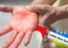 Guillain Barre Syndrome First Case In The State How Dangerous Is It, Guillain Barre Syndrome First Case, First Case In The State, Guillain Barre Syndrome Symptoms, Guillain-Barré syndrome Treatment, Guillain Barré Syndrome, Immune System, Neurological Disorder, Treatment Cost, Hyderabad, Hyderabad Live Updates, Latest Hyderabad News, Telangana, TS Politics, TS Live Updates, Political News, Mango News, Mango News Telugu
