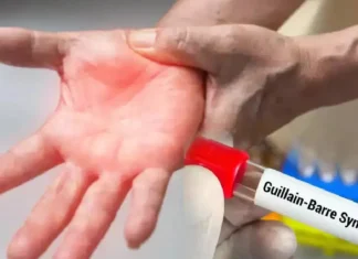 గులియన్ బారే సిండ్రోమ్: రాష్ట్రంలో మొదటి కేసు! Guillain Barre Syndrome First Case In The State How Dangerous Is It, Guillain Barre Syndrome First Case, First Case In The State, Guillain Barre Syndrome Symptoms, Guillain-Barré syndrome Treatment, Guillain Barré Syndrome, Immune System, Neurological Disorder, Treatment Cost, Hyderabad, Hyderabad Live Updates, Latest Hyderabad News, Telangana, TS Politics, TS Live Updates, Political News, Mango News, Mango News Telugu