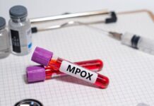 First Mpox Case Reported In Bengaluru Government On High Alert