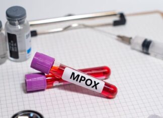 First Mpox Case Reported In Bengaluru Government On High Alert