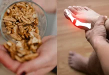 These Can Reduce Uric Acid Levels, Reduce Uric Acid, Tips For Uric Acid, Effects Of Uric Acid, Tips To Reduce Uric Acid, Reduce Uric Acid Levels, Uric Acid, Foods to Help Reduce Uric Acid, Natural Ways to Reduce Uric Acid, Health, Health News, Health Tips, Healthy Food, Healthy Diet, Fitness, Mango News, Mango News Telugu