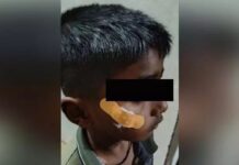నీకోదండం తల్లి.. గాయానికి కుట్లు వేయకుండా. ఫెవిక్విక్ పెడతావా.. ఎక్కడో తెలుసా..? Fevikwik Treatment A Shocking Incident In Karnataka Government Hospital, Fevikwik Treatment, A Shocking Incident In Karnataka, Karnataka Government Hospital, Fevikwik, Government Hospital, Medical Negligence, Nurse, Karnataka, Latest Karnataka News, Live Updates, Breaking News, Headlines, Live News, Mango News, Mango News Telugu