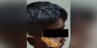 Fevikwik Treatment A Shocking Incident In Karnataka Government Hospital, Fevikwik Treatment, A Shocking Incident In Karnataka, Karnataka Government Hospital, Fevikwik, Government Hospital, Medical Negligence, Nurse, Karnataka, Latest Karnataka News, Live Updates, Breaking News, Headlines, Live News, Mango News, Mango News Telugu