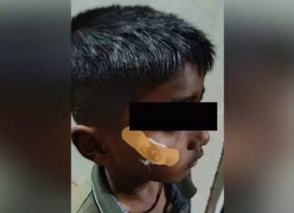 Fevikwik Treatment A Shocking Incident In Karnataka Government Hospital, Fevikwik Treatment, A Shocking Incident In Karnataka, Karnataka Government Hospital, Fevikwik, Government Hospital, Medical Negligence, Nurse, Karnataka, Latest Karnataka News, Live Updates, Breaking News, Headlines, Live News, Mango News, Mango News Telugu