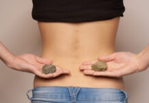 If You Have Kidney Stones You Can Reduce Them Without Going For Surgery, If You Have Kidney Stones, Kidney Stones, You Can Reduce Them Without Going For Surgery, Prevent Kidney Stones, Kidney Stone Diet Plan, Kidney Stones Causes, Health, Health News, Health Tips, Healthy Food, Healthy Diet, Mango News, Mango News Telugu