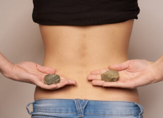 If You Have Kidney Stones You Can Reduce Them Without Going For Surgery, If You Have Kidney Stones, Kidney Stones, You Can Reduce Them Without Going For Surgery, Prevent Kidney Stones, Kidney Stone Diet Plan, Kidney Stones Causes, Health, Health News, Health Tips, Healthy Food, Healthy Diet, Mango News, Mango News Telugu