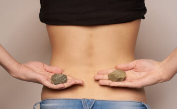 If You Have Kidney Stones You Can Reduce Them Without Going For Surgery, If You Have Kidney Stones, Kidney Stones, You Can Reduce Them Without Going For Surgery, Prevent Kidney Stones, Kidney Stone Diet Plan, Kidney Stones Causes, Health, Health News, Health Tips, Healthy Food, Healthy Diet, Mango News, Mango News Telugu