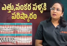 దంతాలు సరిచేసే కొత్త పద్ధతి తెలుసుకోండి – డాక్టర్ రవళి సలహాలు Dr. Ravali About Visible & Invisible Aligners for Teeth