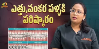 Dr. Ravali About Visible & Invisible Aligners for Teeth