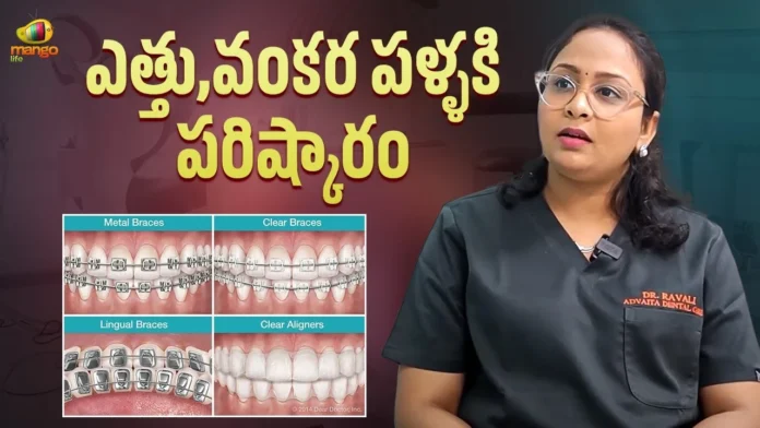 Dr. Ravali About Visible & Invisible Aligners for Teeth Dr. Ravali About Visible & Invisible Aligners for Teeth
